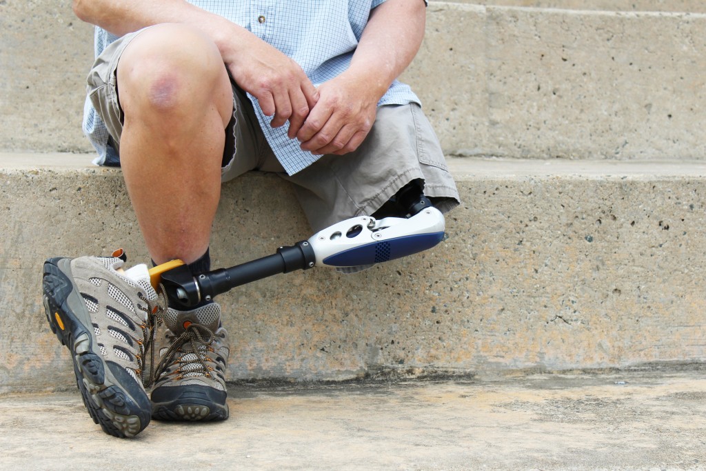 man with a prosthetic leg
