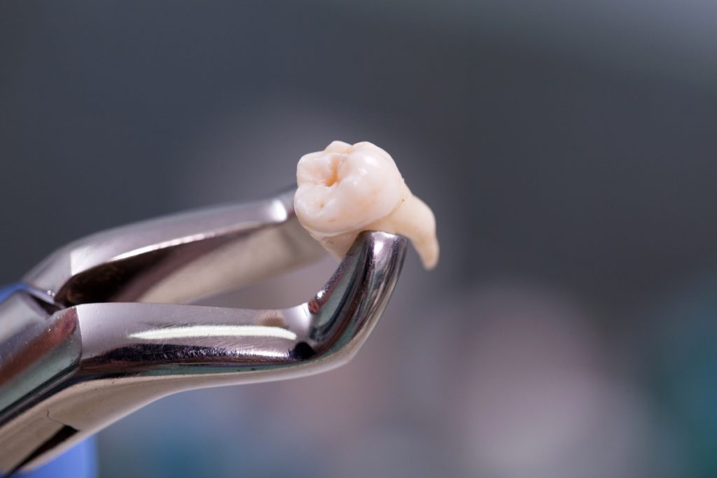 tooth on pliers
